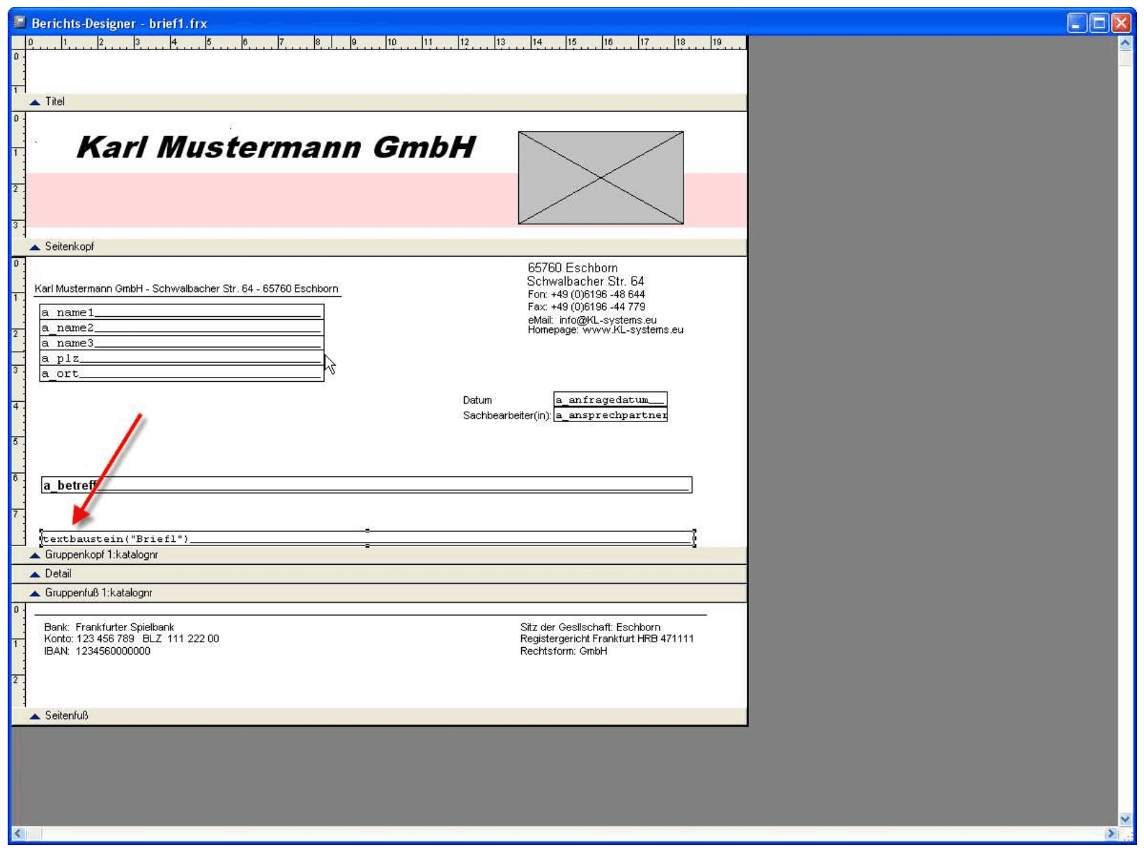 Verwalten der Textbausteine im Reportdesigner